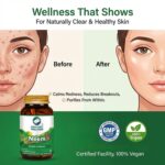 Acne-Never 90 Capsules - Image 2
