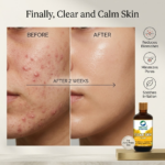 Organic Wellness Clear Skin Lotion - 100 ml - Image 9