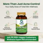 Acne-Never 90 Capsules - Image 9